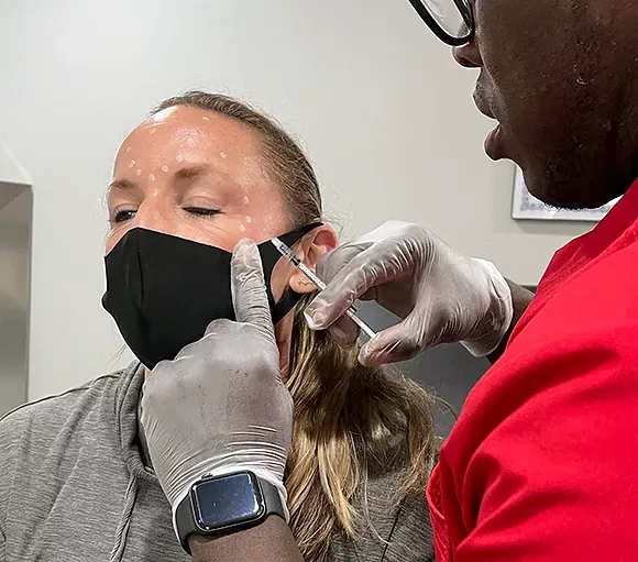 BOTOX-TREATMENTS-GENTLE-GIANT-CARE-in-palm-springs-ca