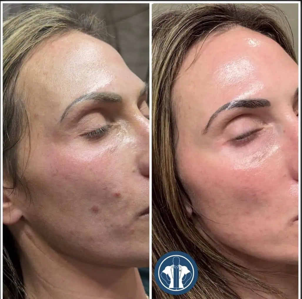Skin gentle-giant-care-before-after-three