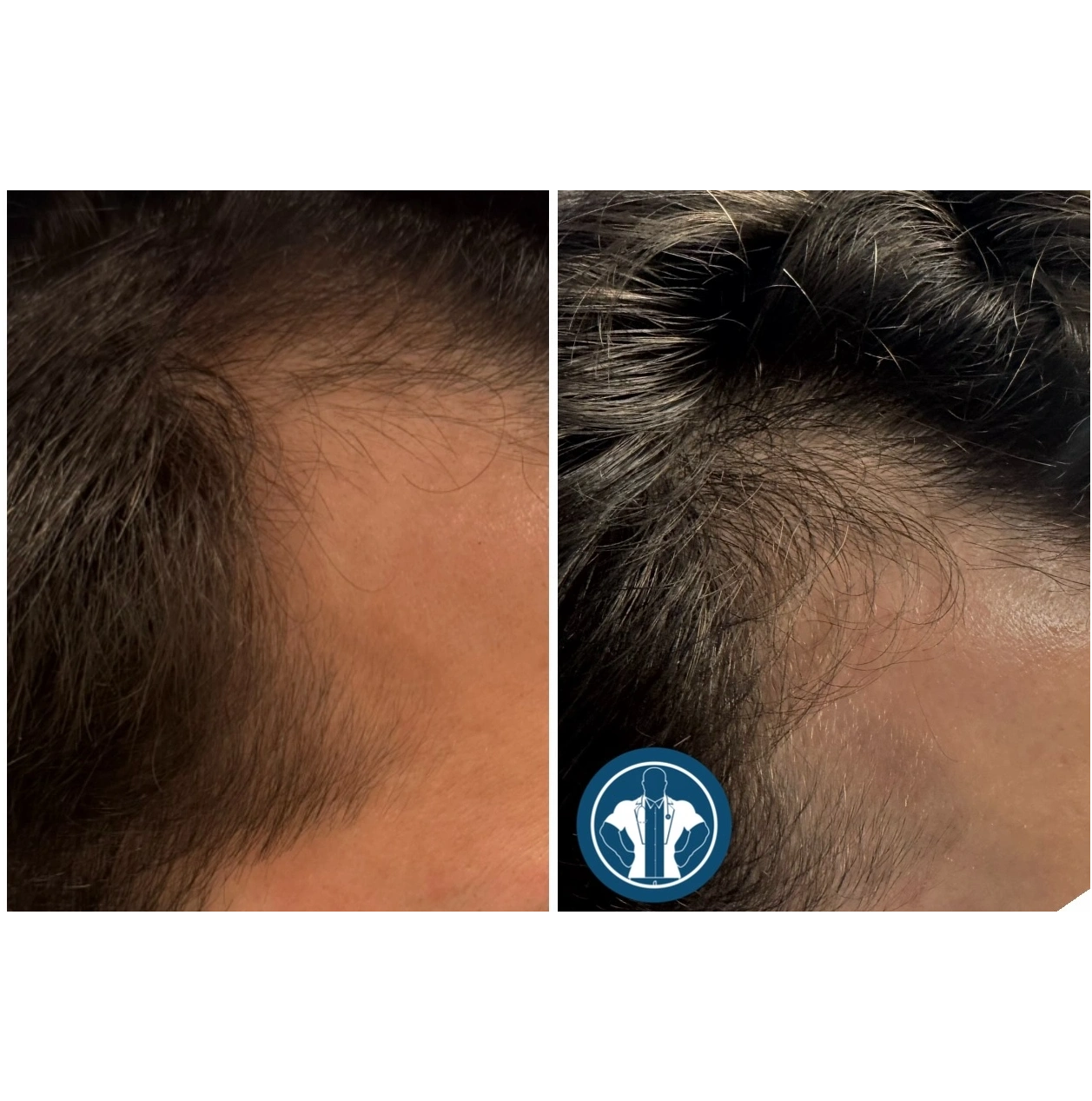 hair (1)