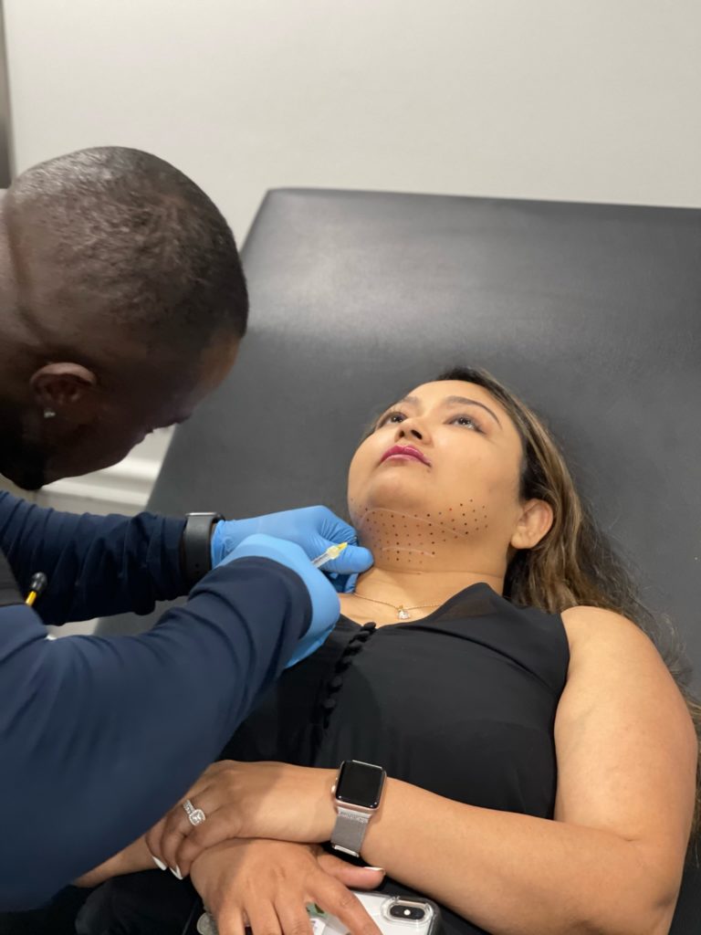 Portfolio 2 Kybella for double chin treatment in Atlanta GA by Gentle Giant care