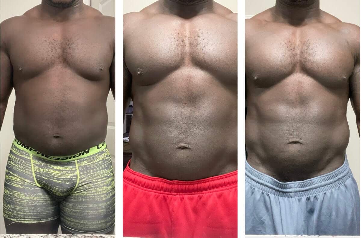 Before and After Weight Loss | Gentle Giant Care In Atlanta, GA, Lauderdale and Miami, FL