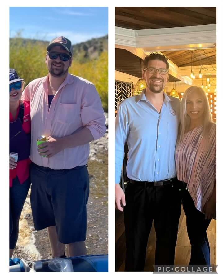 Before and After Weight Loss | Gentle Giant Care In Atlanta, GA, Lauderdale and Miami, FL