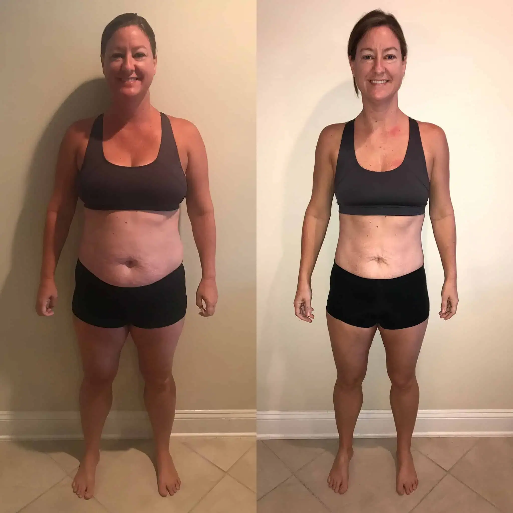 Before and After Weight Loss | Gentle Giant Care In Atlanta, GA, Lauderdale and Miami, FL